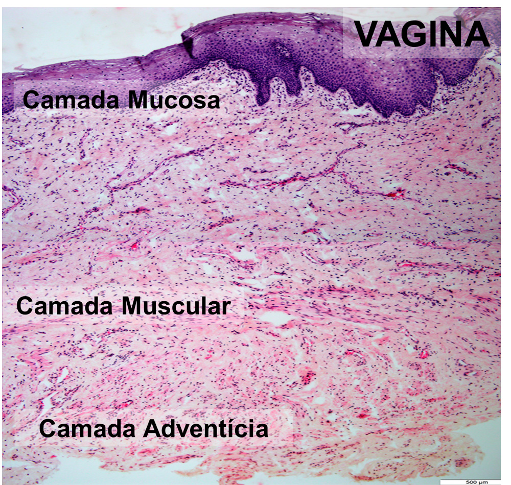 Sistema Reprodutor Feminino Histologia De rg os E Sistemas Sistema Reprodutor Feminino Histologia De rg os E Sistemas
