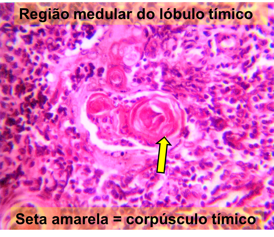 Sistema Imune Histologia De Rg Os E Sistemas